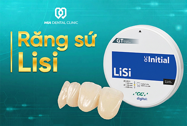 Răng sứ Lisi