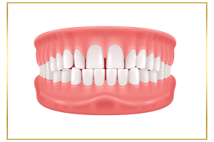 hình ảnh răng thưa